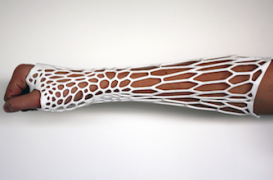 Un plâtre révolutionnaire conçu par un étudiant